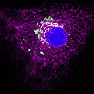 Desenvolupen una nova estratègia per millorar la cicatrització de la pell i prevenir la fibrosi